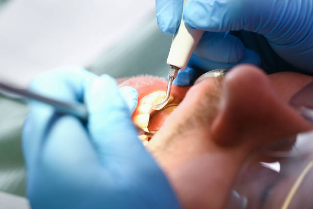 Best Weekend Emergency Dentist in Buzzards Bay, MA