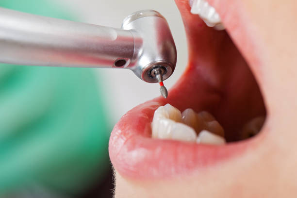 Professional Emergency Dentist in MA